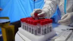 注冊(cè)檢測(cè)公司需要哪些材料？